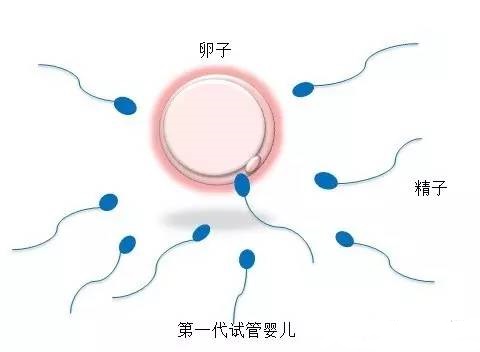 爱心同性供卵代孕微信群